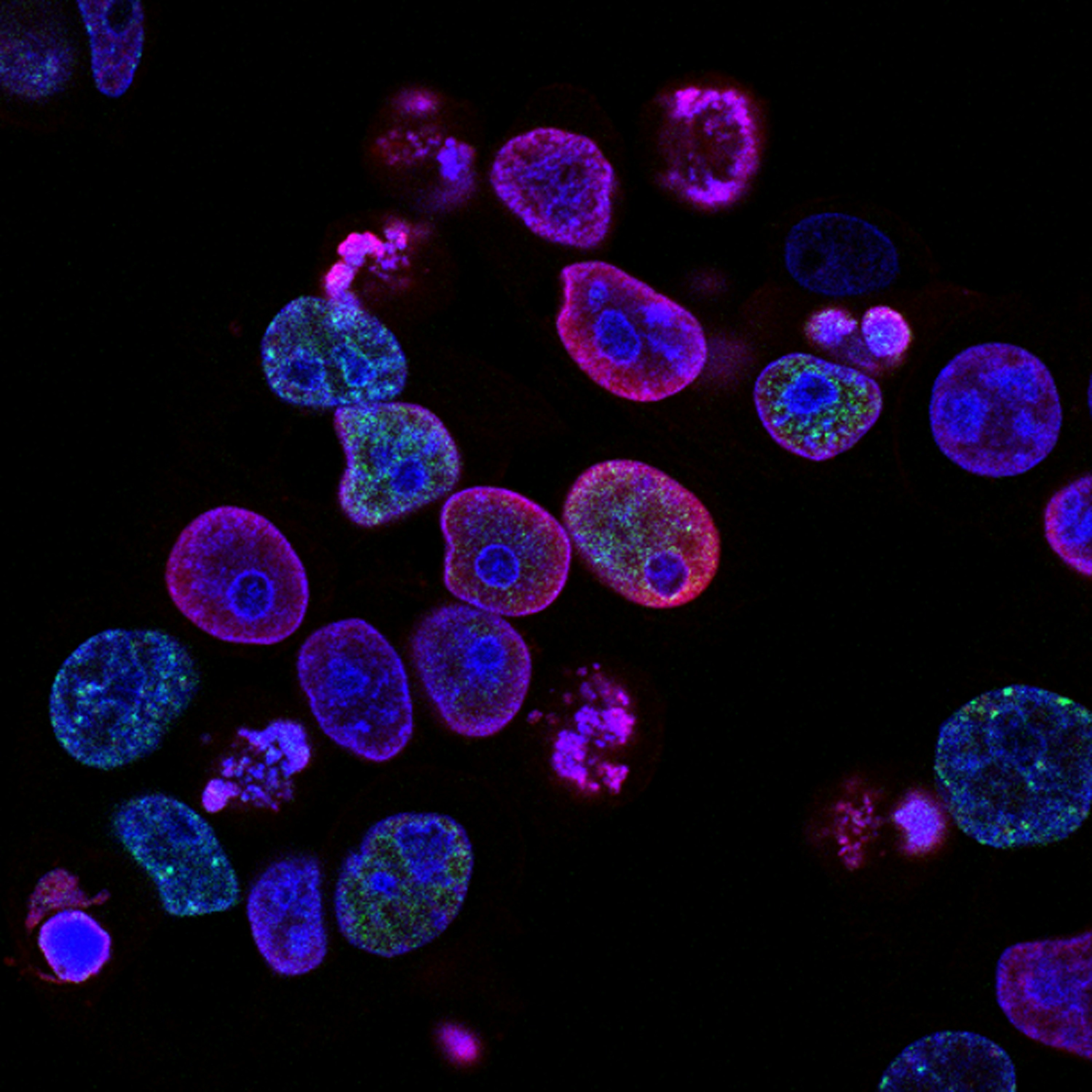 A fluorescent microscopy study of living cells